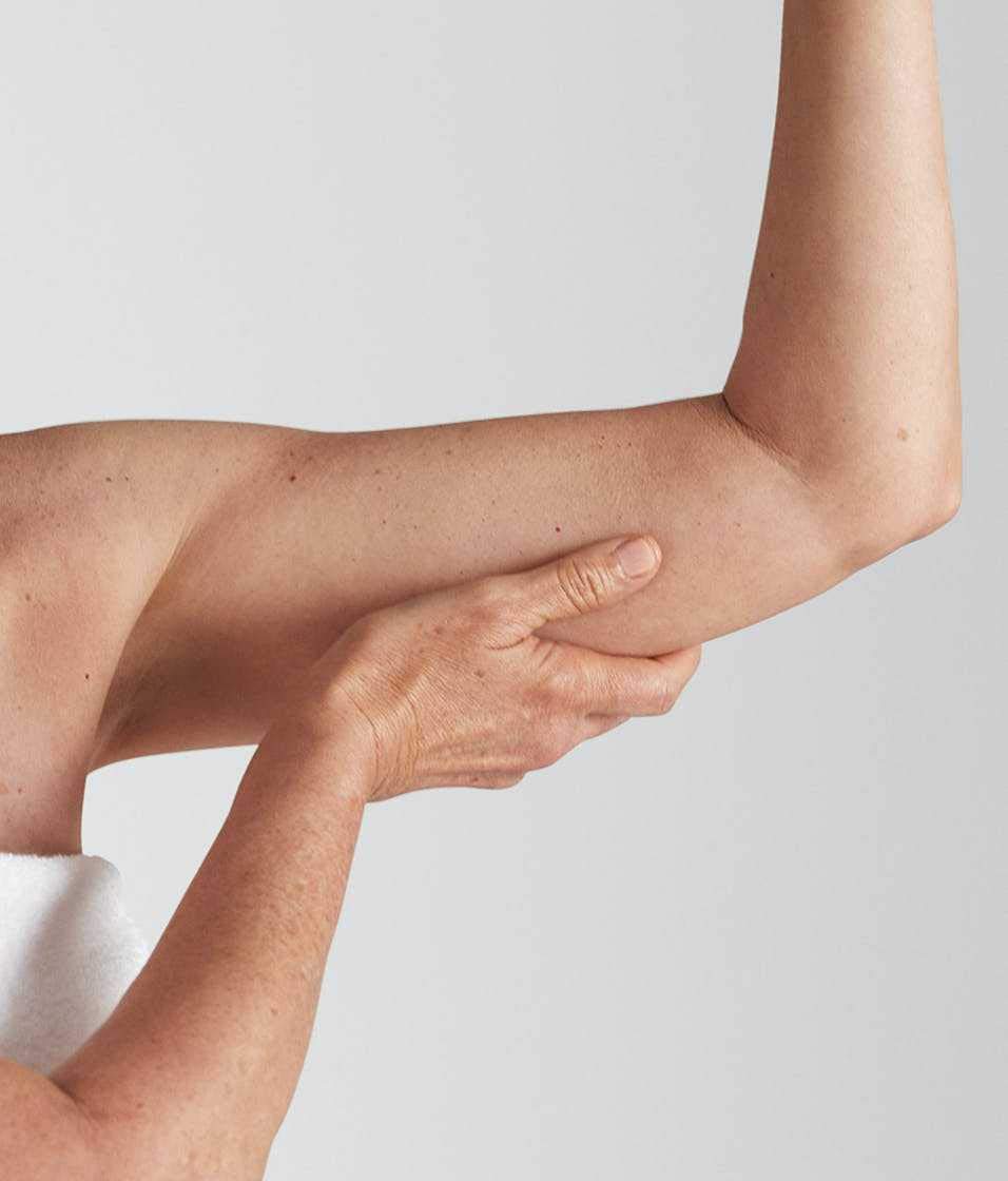 StriVectin before and after arms comparison showing improved texture appearance