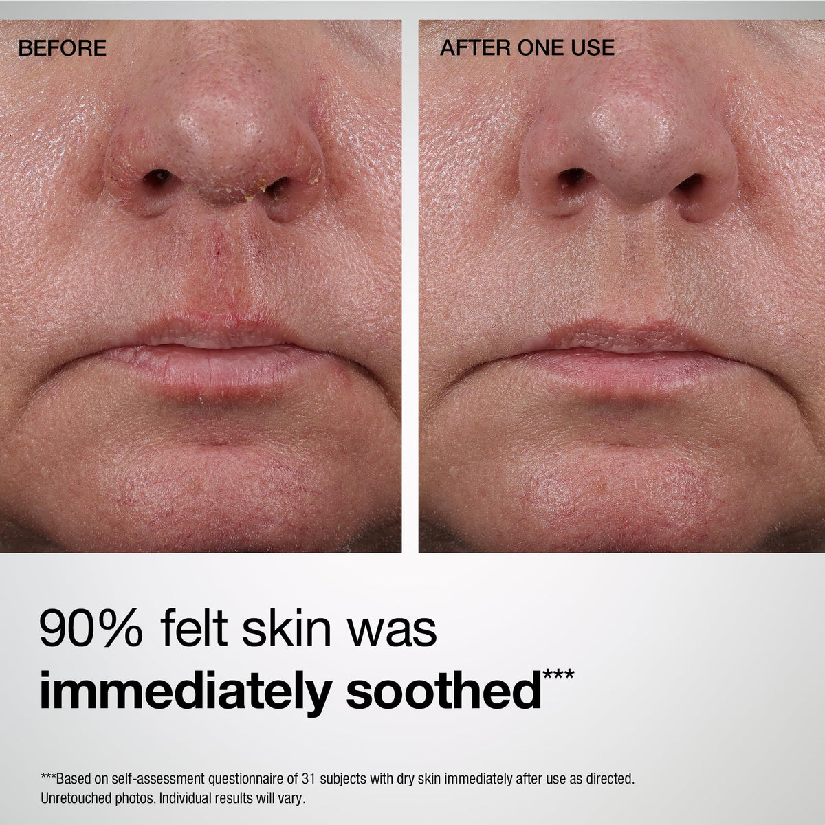 StriVectin before and after illustration suggesting improved texture benefit
