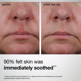 StriVectin before and after illustration suggesting improved texture benefit