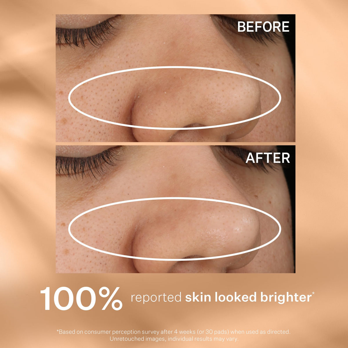 StriVectin comparative skin texture before and after regular use clarity