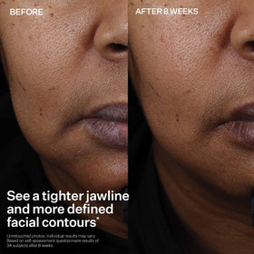 StriVectin bottle label close-up highlighting peptide blend and ingredient transparency