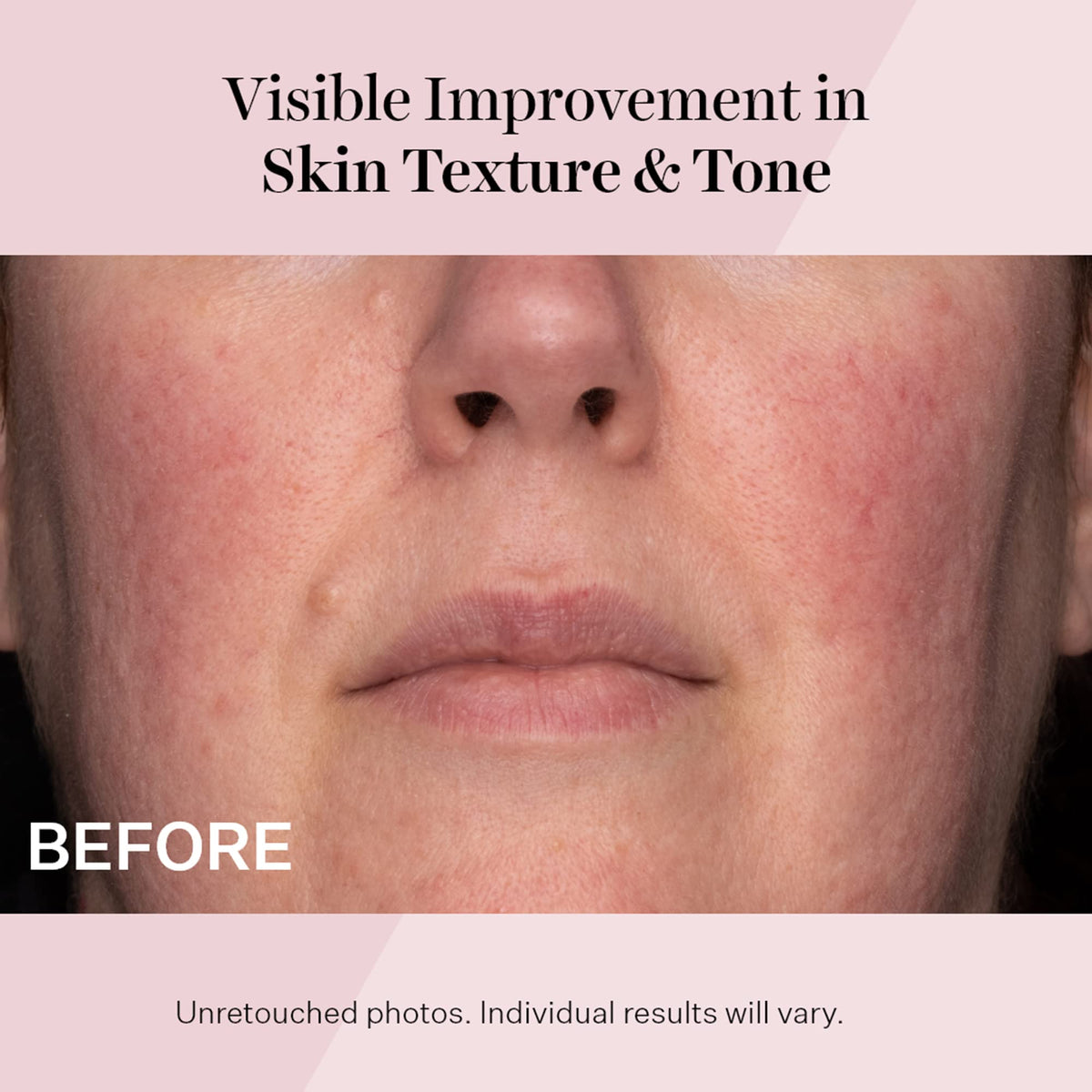 StriVectin moisturizer applied to cheek for visible smoothing benefit