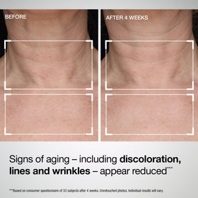StriVectin lotion covering décolleté illustrating even coverage benefit