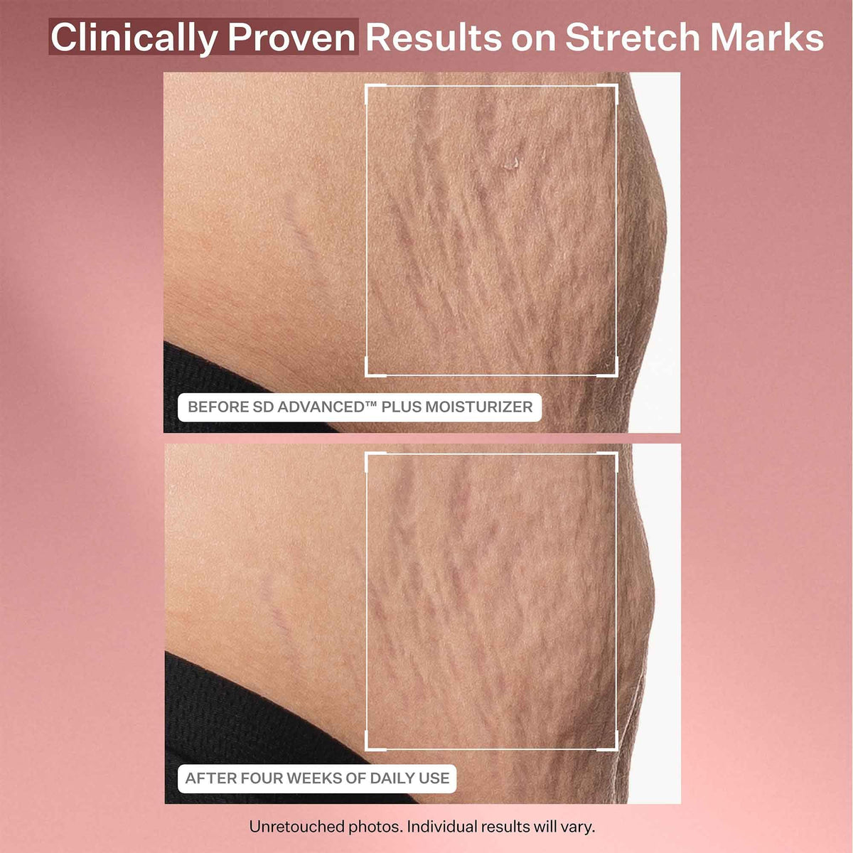 StriVectin Intensive Eye Concentrate tube close-up showing precise applicator benefit