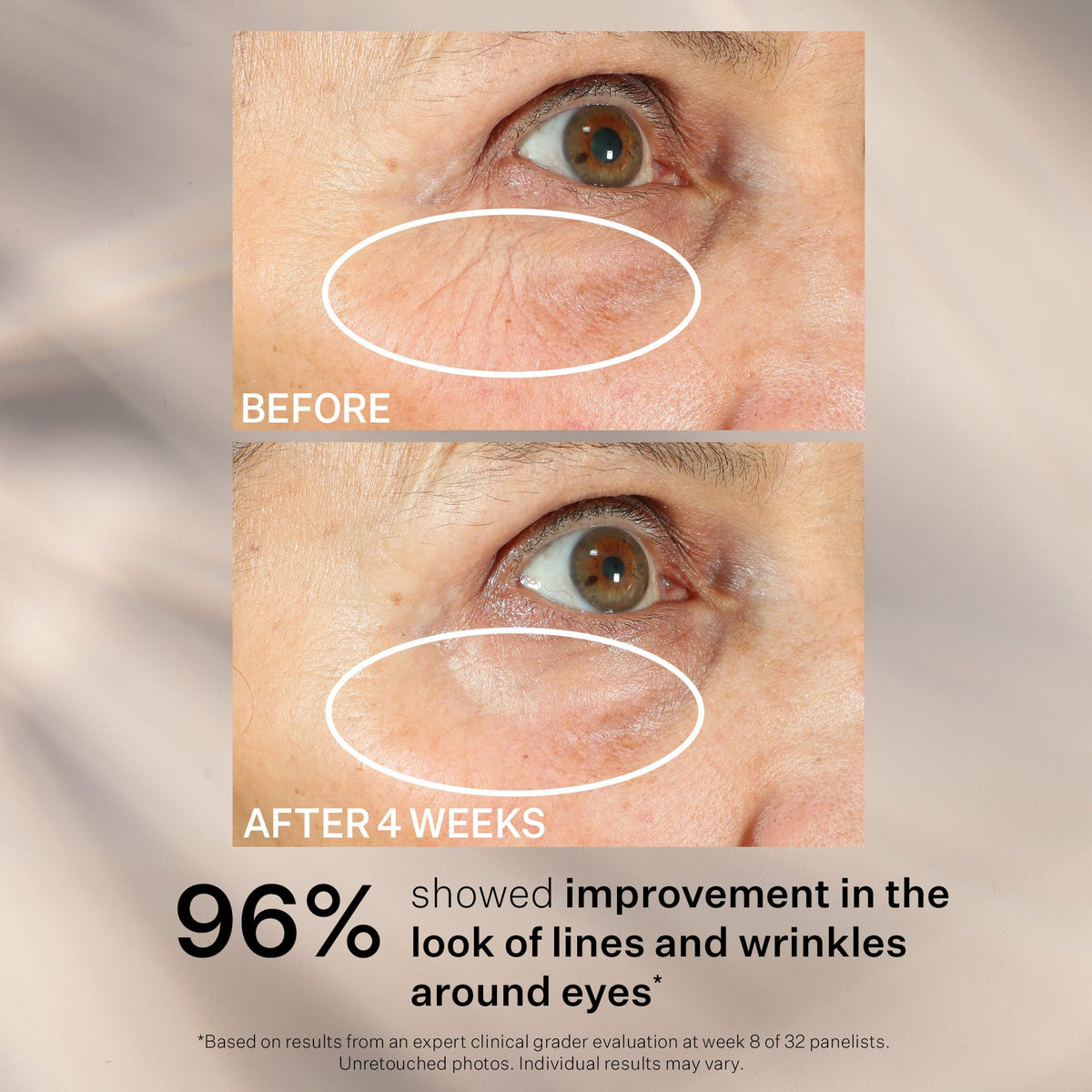 StriVectin morning routine lifestyle shot showing refreshed, awake eye benefit