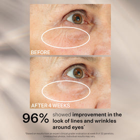 StriVectin morning routine lifestyle shot showing refreshed, awake eye benefit