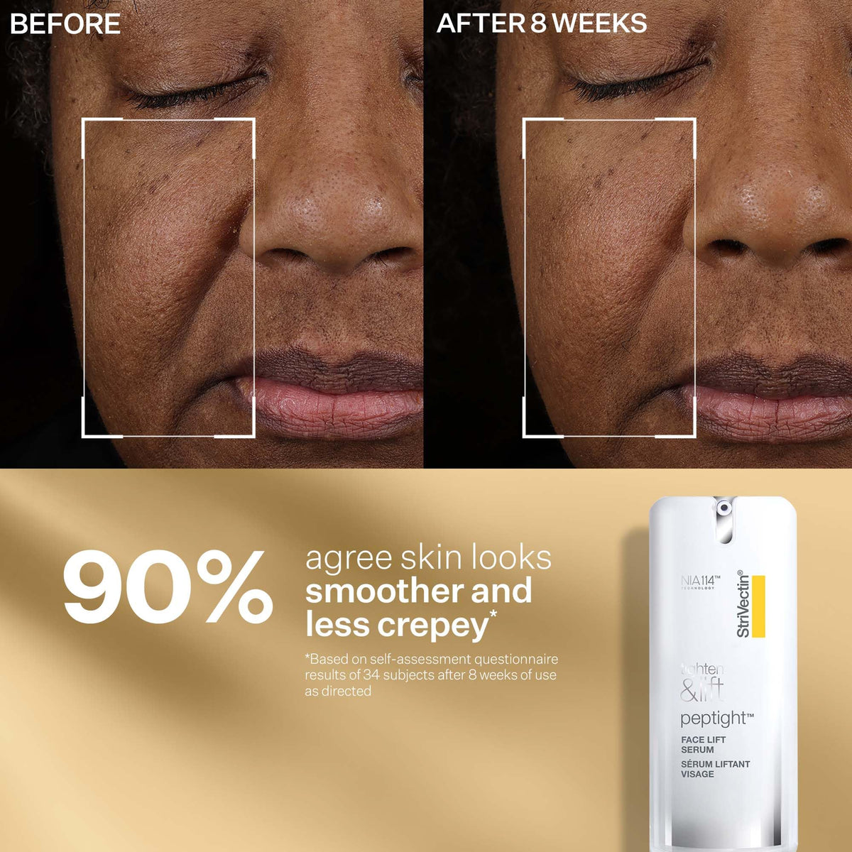 StriVectin neck cream open jar showing rich texture for firming
