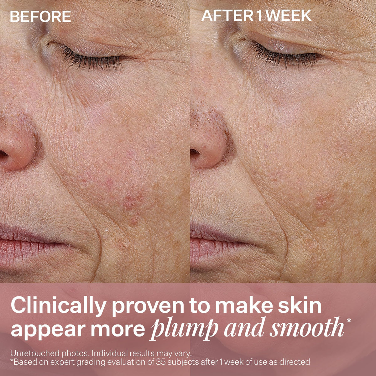 StriVectin product label close-up listing Alpha 3 Peptide and Argireline benefits