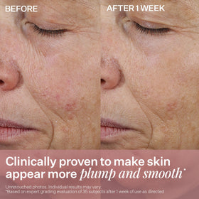 StriVectin product label close-up listing Alpha 3 Peptide and Argireline benefits