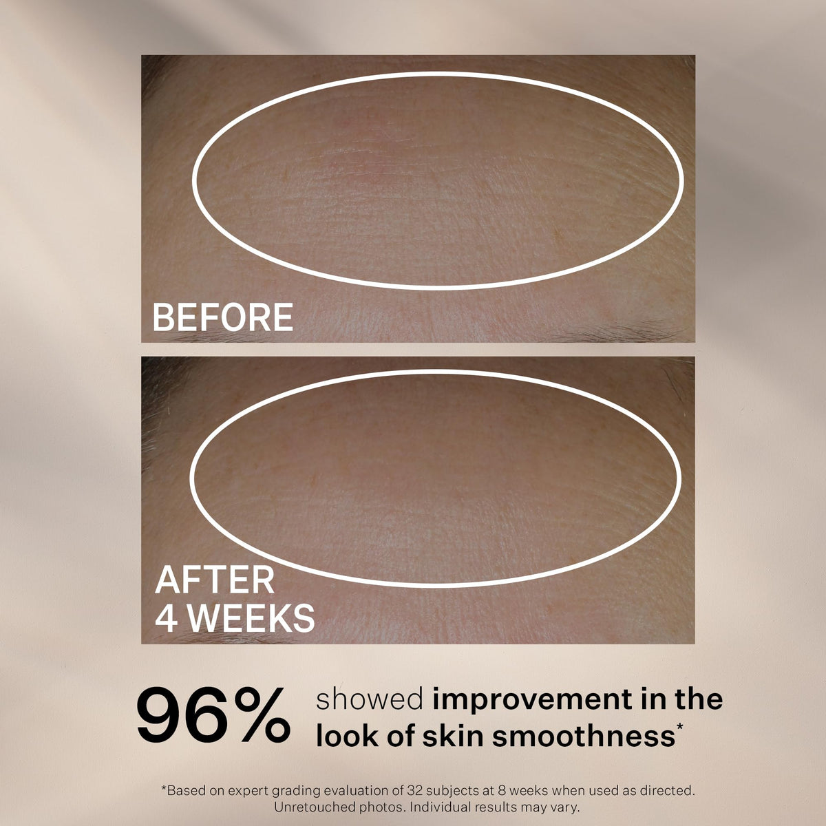 StriVectin applying serum to cheek demonstrating smooth, hydrating benefit