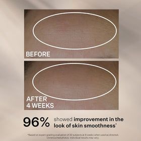 StriVectin applying serum to cheek demonstrating smooth, hydrating benefit