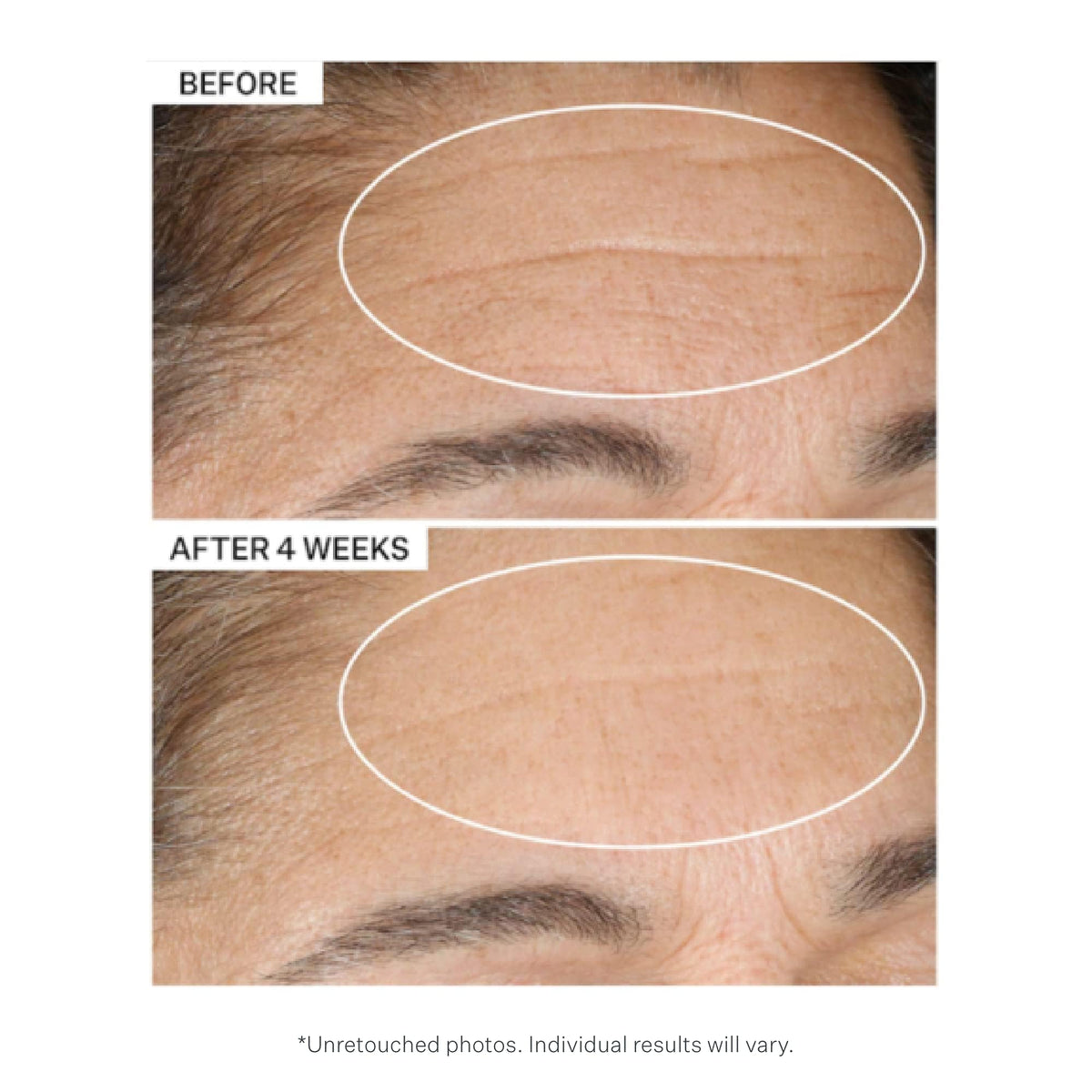 StriVectin jar opened with visible cream for effortless night application