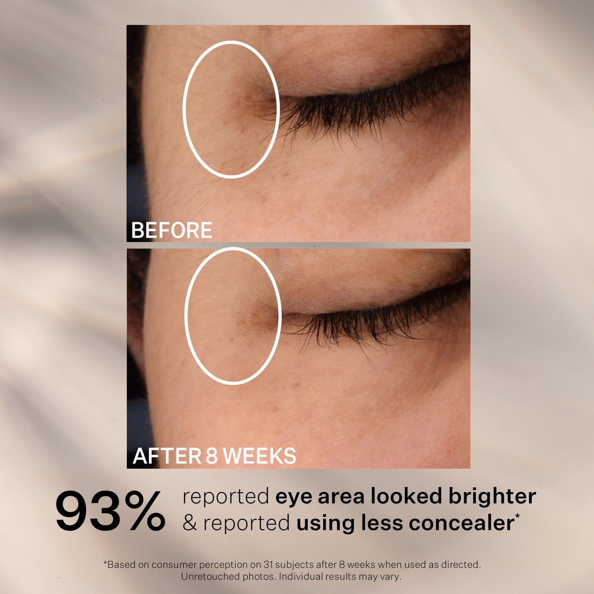StriVectin Super C before and after visual suggesting brighter under-eye