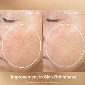 StriVectin used on neck and décolleté showing smoothing and texture improvement