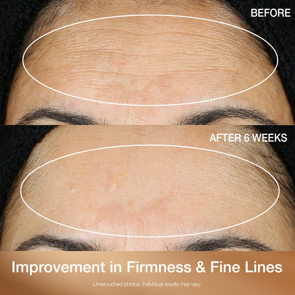 StriVectin serum applied to back of hand demonstrating targeted brightening benefit