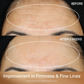 StriVectin serum applied to back of hand demonstrating targeted brightening benefit