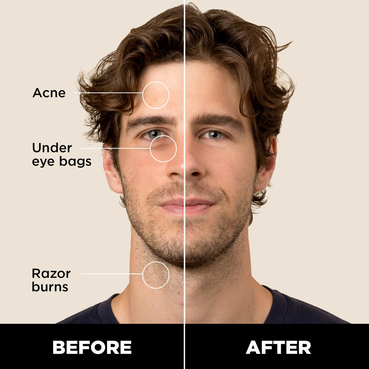 Stryx concealer open with twist mechanism visible for precise application benefit