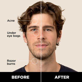 Stryx concealer open with twist mechanism visible for precise application benefit