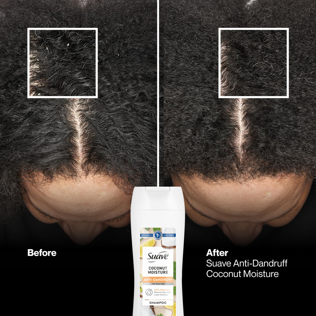 Suave shampoo in palm to show bottle size and easy dispensing benefit