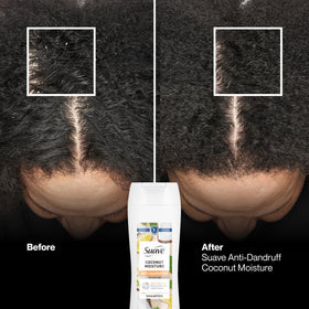 Suave shampoo in palm to show bottle size and easy dispensing benefit