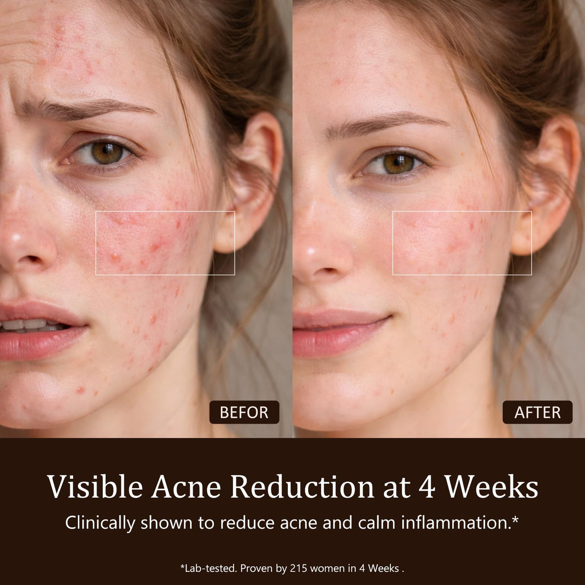 SUBRUN mask worn while user relaxes, hands-free treatment benefit