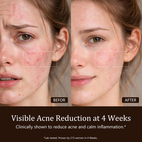 SUBRUN mask worn while user relaxes, hands-free treatment benefit