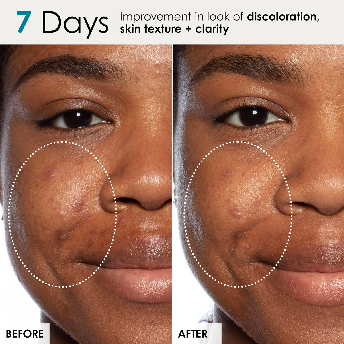 Sunday Riley spread on skin showing smoothening effect and radiance