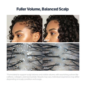 SUNGBOON EDITOR scalp application in use for targeted spot treatment