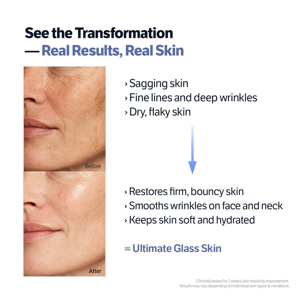 SUNGBOON EDITOR refined white spicules detail highlighting smoothing finish