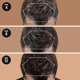 Superior Mane before and after visual indicating fuller-looking hair benefit