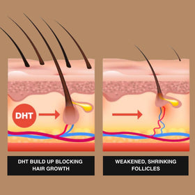 Superior Mane label close-up showing ROOTGEN COMPLEX and key actives