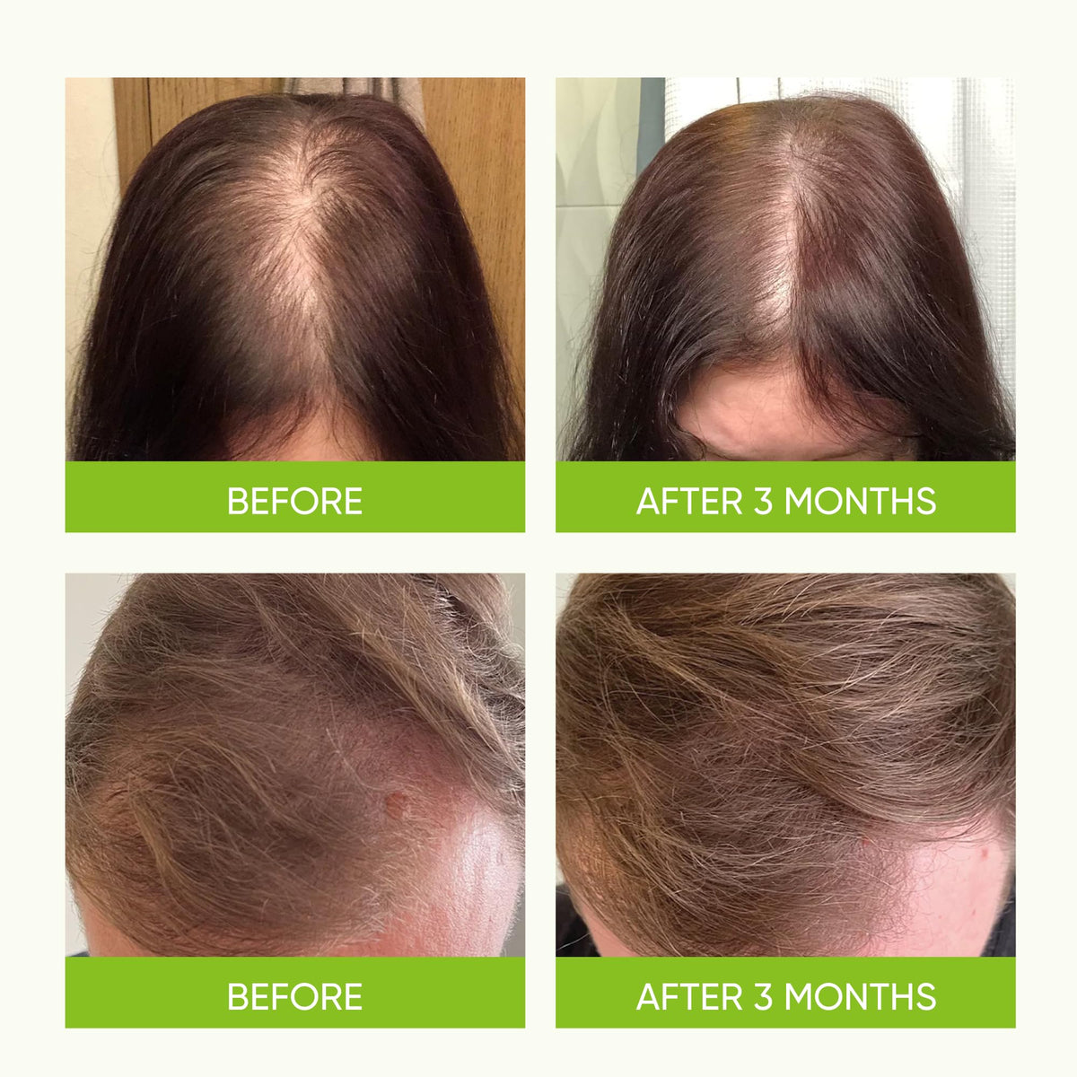 Svvimer rosemary and batana oil ingredients highlighting natural nourishment