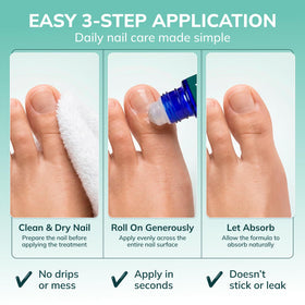 Swissklip KlearNail being applied to toenail demonstrating targeted nail care