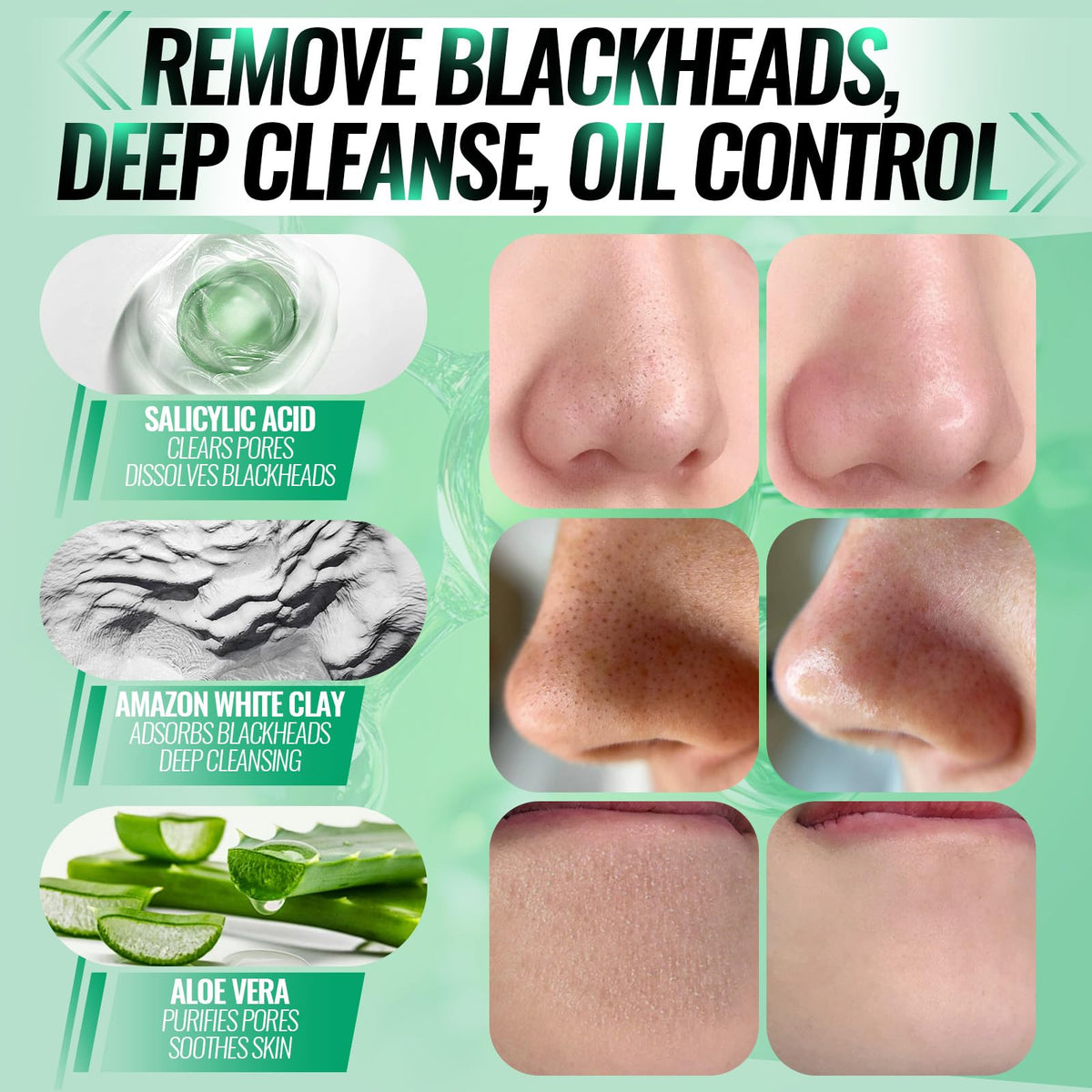 SYABO peeling process mid-removal showing effective blackhead extraction