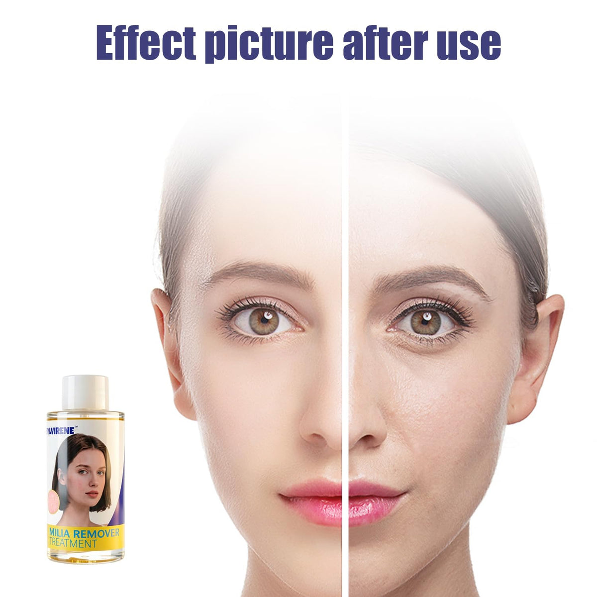 Sylvirene applying serum under-eye for targeted milia treatment