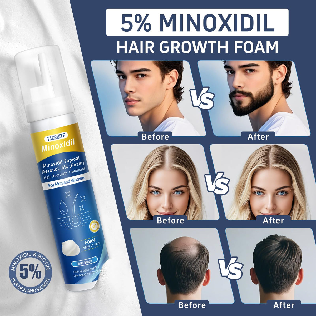 Tacruitf applied to scalp demonstrating easy application and coverage