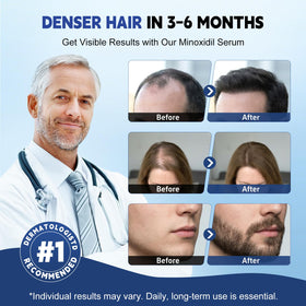 Tacruitf liquid texture on scalp demonstrating fast absorption benefit