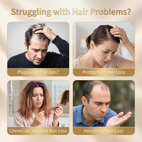 TAGOQHIA roll-on being applied to scalp, benefit of mess-free targeted treatment