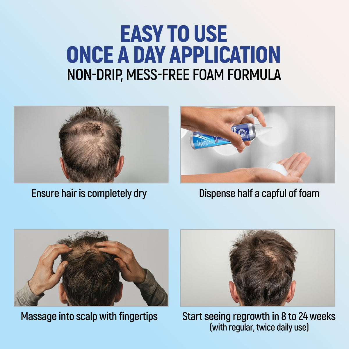 TARO foam being applied to scalp showing targeted application benefit