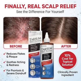 Tarsum gel texture close-up illustrating spreadable exfoliating formula