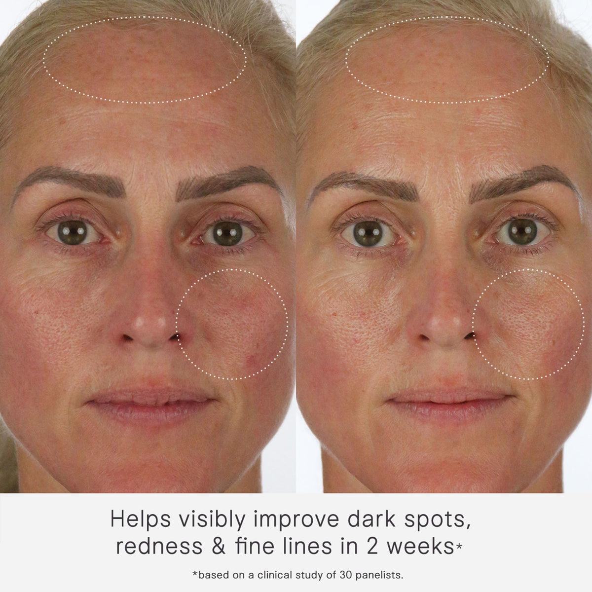Close-up of ectoin ingredient representation highlighting soothing benefit