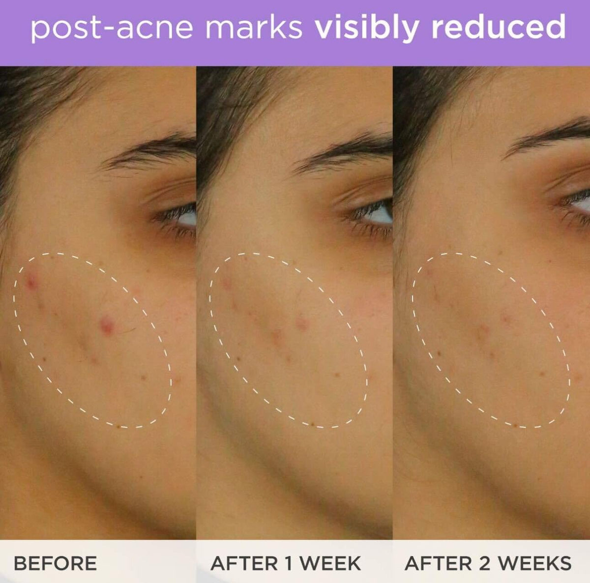 TATCHA close-up of ferulic acid concept ingredient supporting antioxidant protection