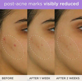 TATCHA close-up of ferulic acid concept ingredient supporting antioxidant protection