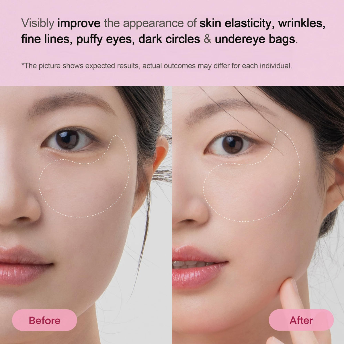 TEREZ & HONOR patch applied under-eye demonstrating instant refresh