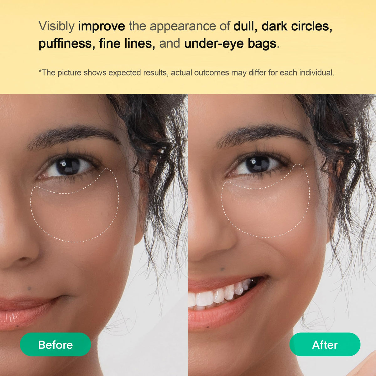 TEREZ & HONOR patch applied under eye demonstrating snug fit and smoothing
