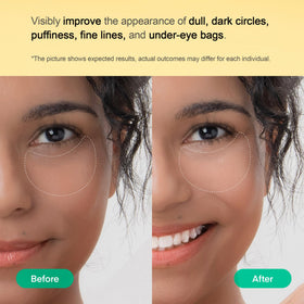 TEREZ & HONOR patch applied under eye demonstrating snug fit and smoothing