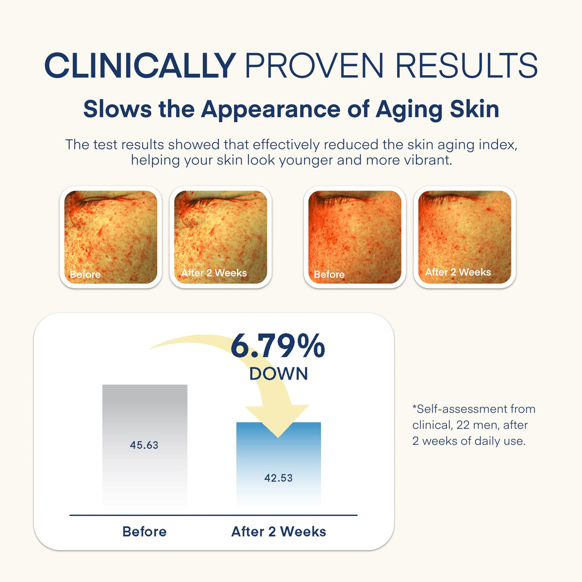TEREZ & HONOR on post-shave skin illustrating calming, soothing benefit