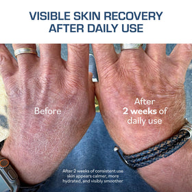 TERNS moisturizer applied to hand showing hydration and quick-absorbing benefit