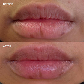TERNS lip balm being applied to lips demonstrating non-sticky comfort and instant smoothing benefit