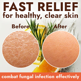 Terramed Just Think Comfort ingredient label showing Tolnaftate 1% for targeted antifungal support